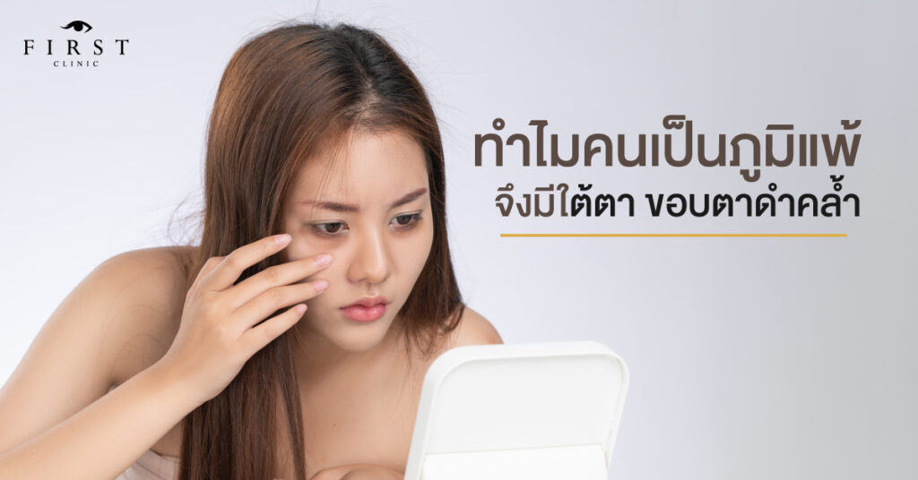 ทำไมคนเป็นภูมิแพ้จึงมีใต้ตา ขอบตาดำคล้ำ