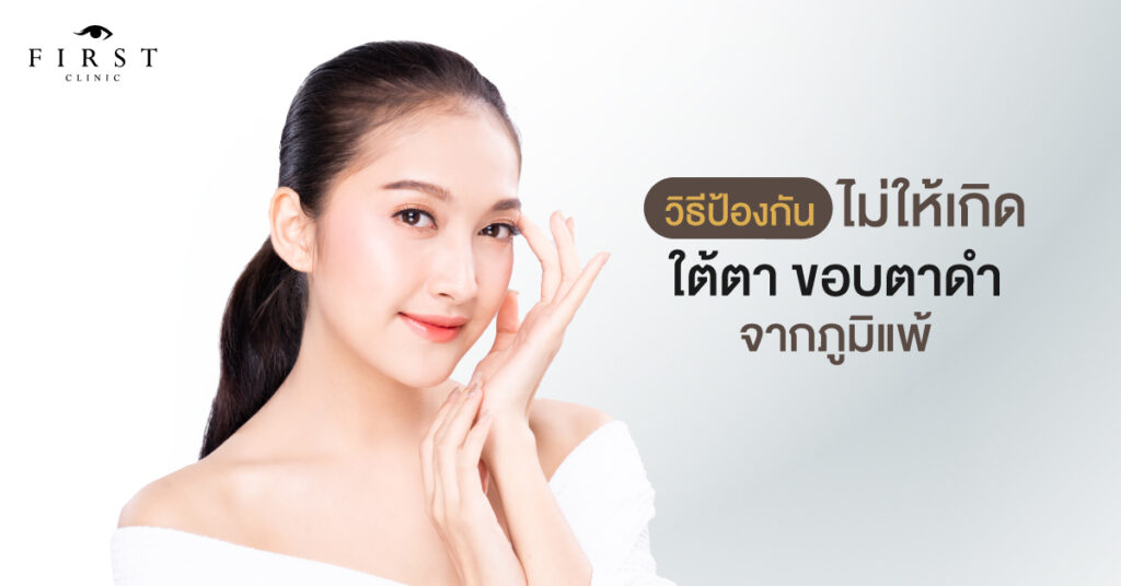 วิธีป้องกันไม่ให้เกิดใต้ตา ขอบตาดำจากภูมิแพ้