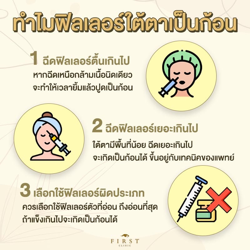 ทำไมฟิลเลอร์ใต้ตาเป็นก้อน